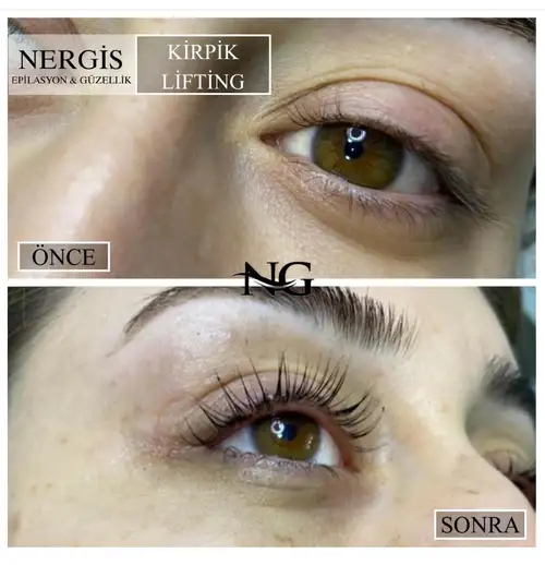 Nergis Epilasyon ve Güzellik - 1. Fotoğraf Nergis Epilasyon ve Güzellik - 1. Fotoğraf
